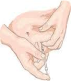 Palmetto: HbA1c Twice Yearly For DMII Patients if Stable, Quarterly if Not