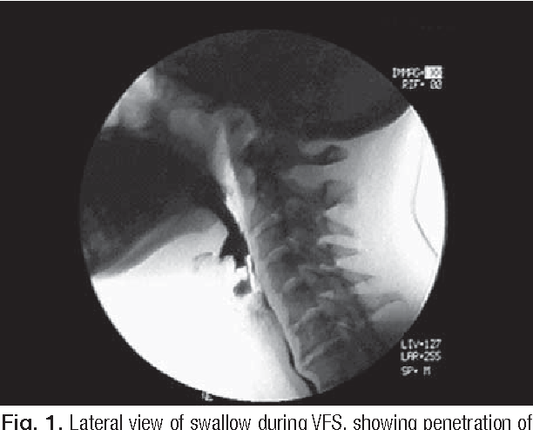 OASIS-E1 Section K - Swallowing/Nutritional Status